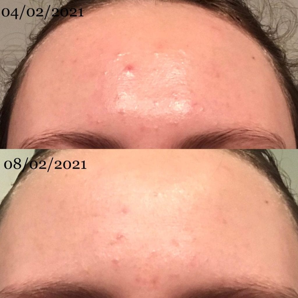 lumispa reviews before after